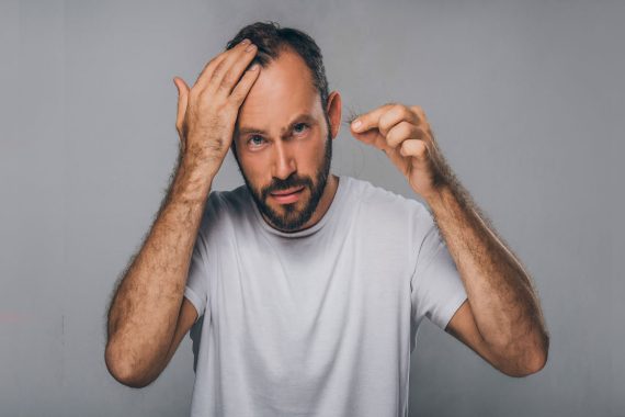 Łysienie u mężczyzn i kobiet – metody leczenia