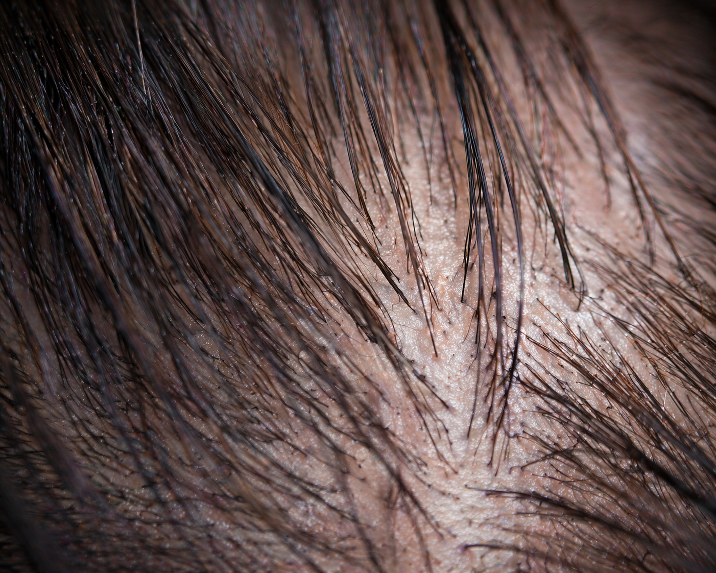 Szczeg&oacute;ły ludzkiej sk&oacute;ry i włos&oacute;w